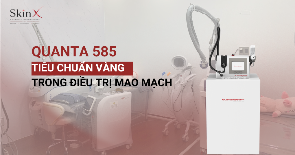 Laser 585: Giải pháp vàng cho da đỏ, mụn viêm &amp; rosacea&nbsp;